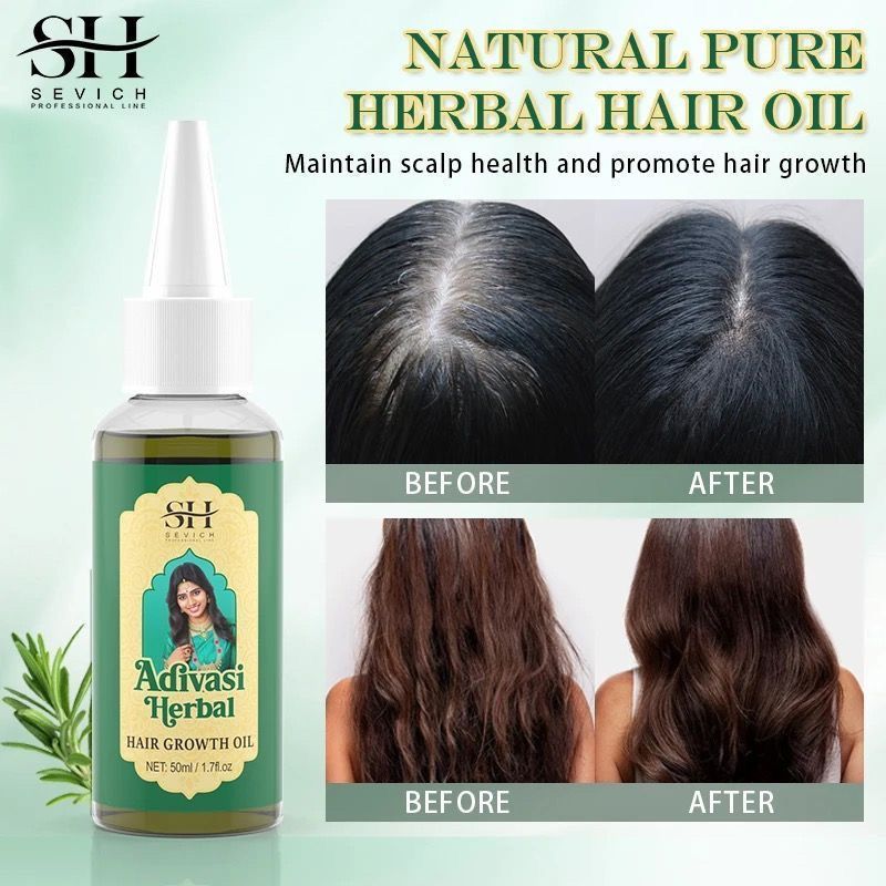 زيت أيورفيدا لنمو الشعر من اله - مراجعة Ayurvedic & Herbal Wellness Kits وسعره